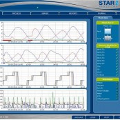 Sterowanie oczyszczalnią ścieków. Nowoczesne metody – aspekty techniczne i ekonomiczne Sterowanie oczyszczalnią ścieków. Nowoczesne metody – aspekty techniczne i ekonomiczne