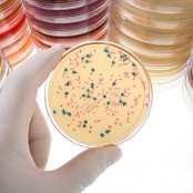 BIOfilmowe oczyszczanie